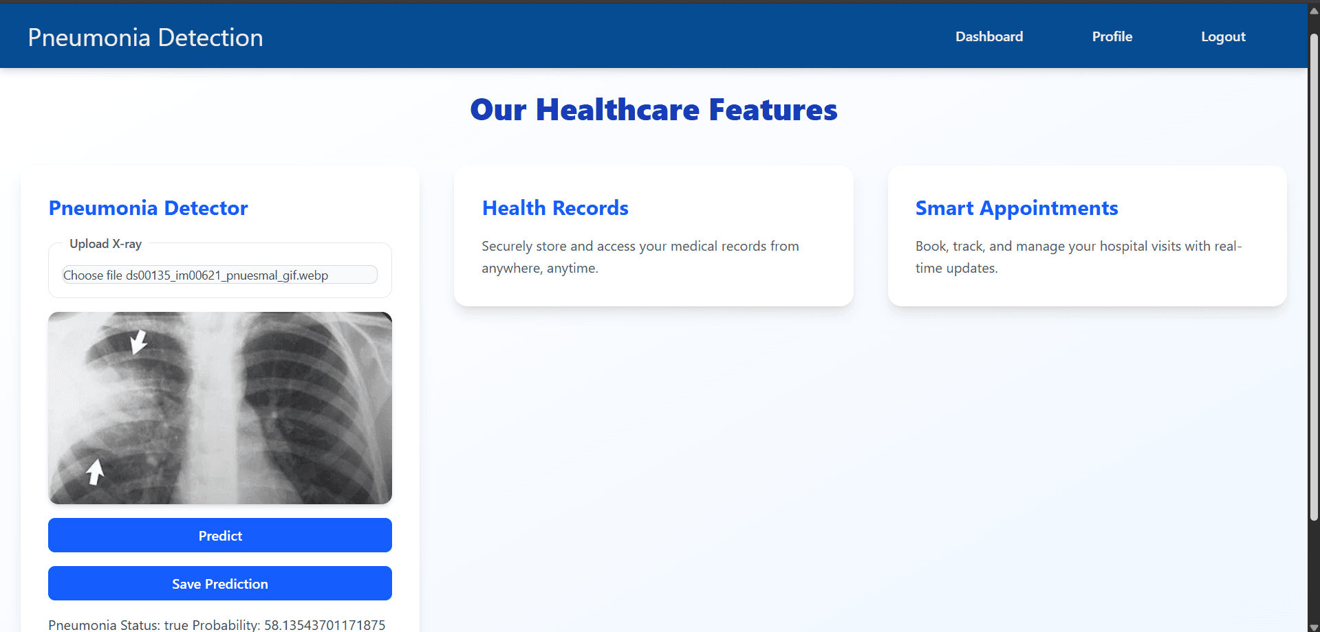 Pneumonia Chest X-Ray Classifier